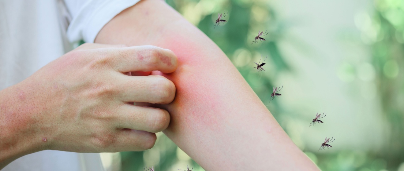 Why Do I Have a Mosquito Problem in My Backyard?